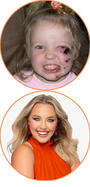 Before and after photos showing dental transformation.